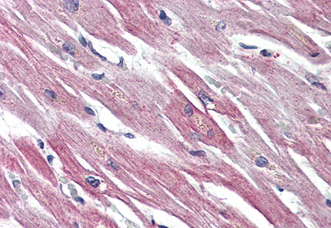 EPHX2 Antibody in Immunohistochemistry (Paraffin) (IHC (P))