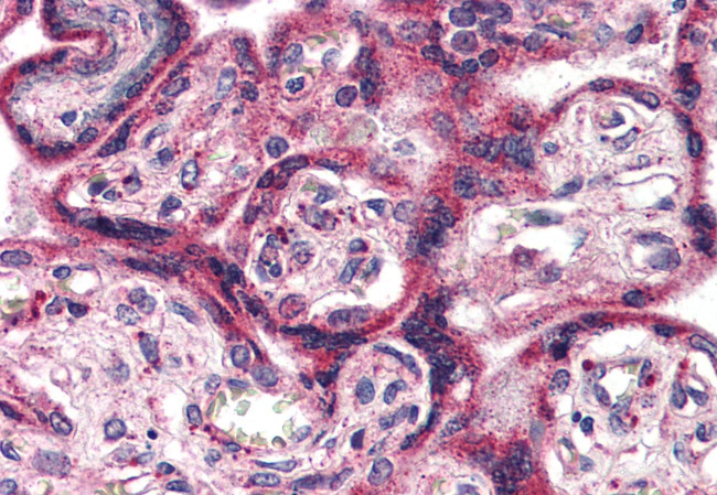 EPHX2 Antibody in Immunohistochemistry (Paraffin) (IHC (P))