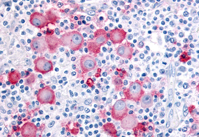 EPHX2 Antibody in Immunohistochemistry (Paraffin) (IHC (P))