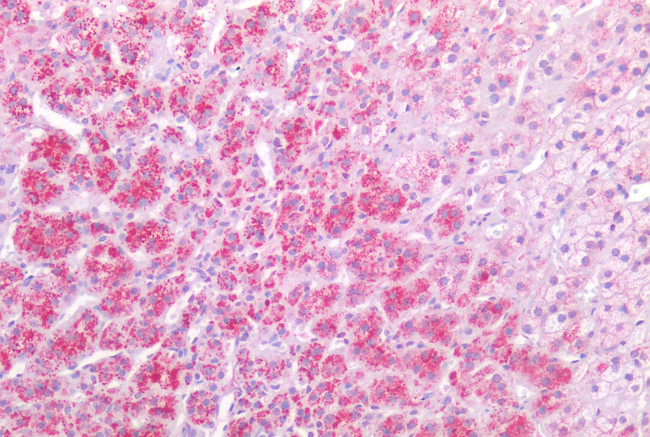 FAP Antibody in Immunohistochemistry (Paraffin) (IHC (P))