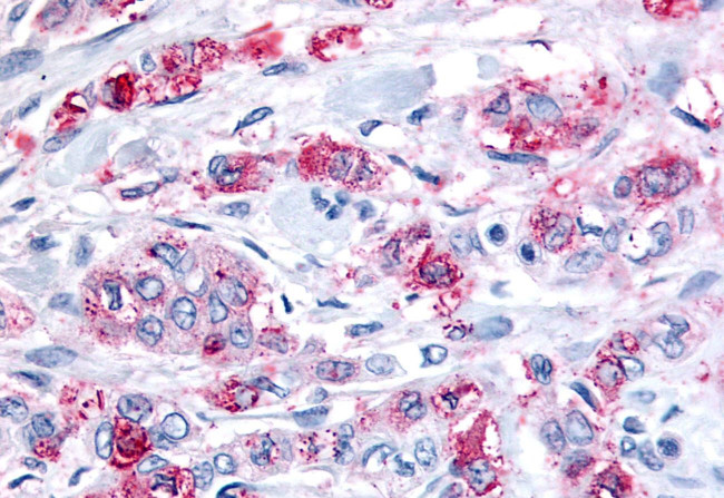 GPR43 Antibody in Immunohistochemistry (Paraffin) (IHC (P))