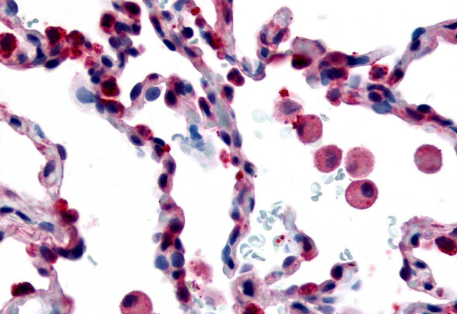 GPR43 Antibody in Immunohistochemistry (Paraffin) (IHC (P))