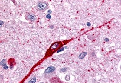 GPR43 Antibody in Immunohistochemistry (Paraffin) (IHC (P))