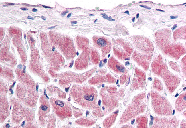 FZD7 Antibody in Immunohistochemistry (Paraffin) (IHC (P))