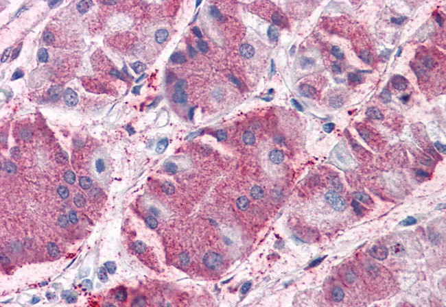 GCNT3 Antibody in Immunohistochemistry (Paraffin) (IHC (P))