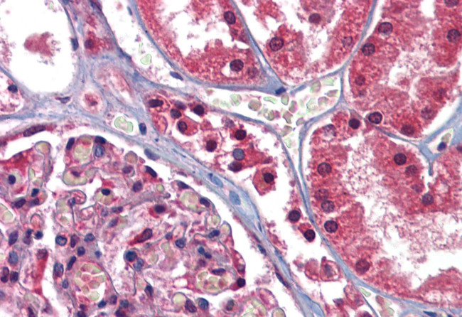 GFPT1 Antibody in Immunohistochemistry (Paraffin) (IHC (P))