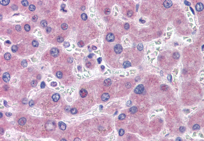 GFPT1 Antibody in Immunohistochemistry (Paraffin) (IHC (P))