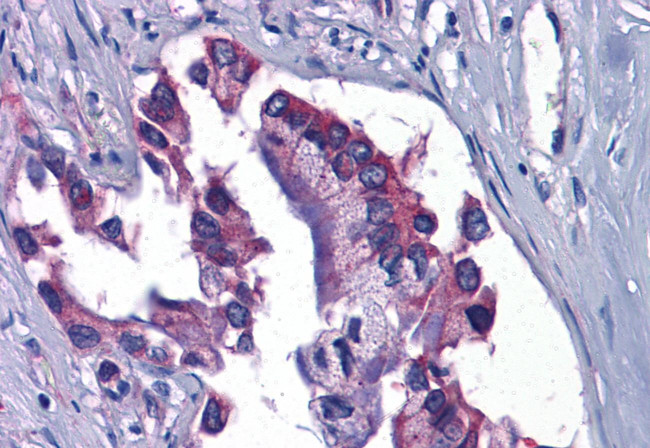 GFPT1 Antibody in Immunohistochemistry (Paraffin) (IHC (P))