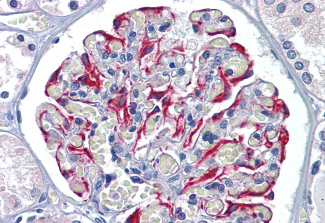 GFPT1 Antibody in Immunohistochemistry (Paraffin) (IHC (P))