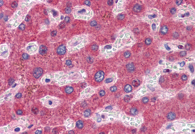 GFPT1 Antibody in Immunohistochemistry (Paraffin) (IHC (P))