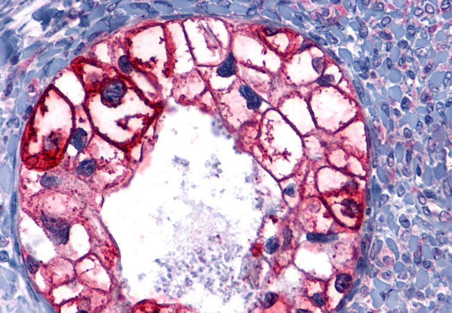 GPR101 Antibody in Immunohistochemistry (Paraffin) (IHC (P))