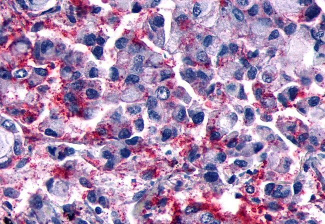 GPR101 Antibody in Immunohistochemistry (Paraffin) (IHC (P))