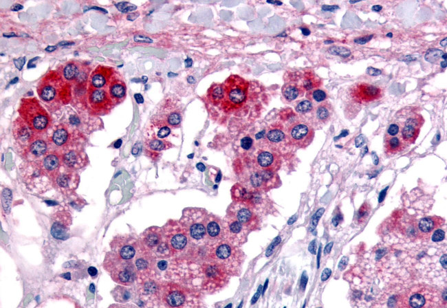 GPR182 Antibody in Immunohistochemistry (Paraffin) (IHC (P))