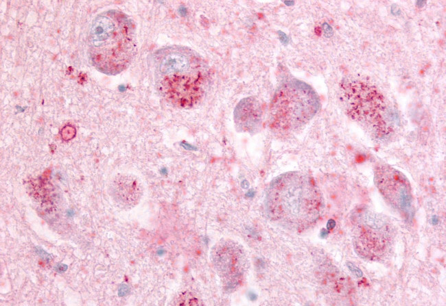 GPR21 Antibody in Immunohistochemistry (Paraffin) (IHC (P))