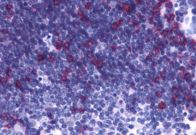 CRTH2 Antibody in Immunohistochemistry (Paraffin) (IHC (P))