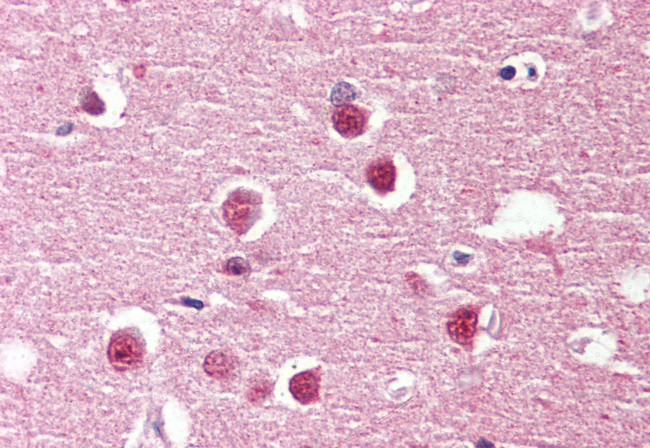 GPR98 Antibody in Immunohistochemistry (Paraffin) (IHC (P))