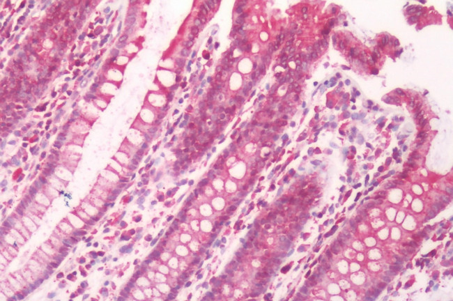 GPRC5B Antibody in Immunohistochemistry (Paraffin) (IHC (P))