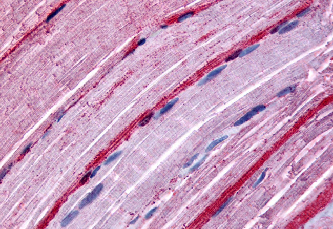 GRK5 Antibody in Immunohistochemistry (Paraffin) (IHC (P))