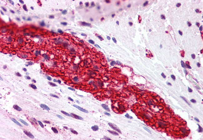 mGluR5 Antibody in Immunohistochemistry (Paraffin) (IHC (P))