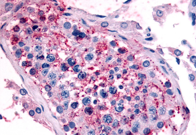 HTR1E Antibody in Immunohistochemistry (Paraffin) (IHC (P))