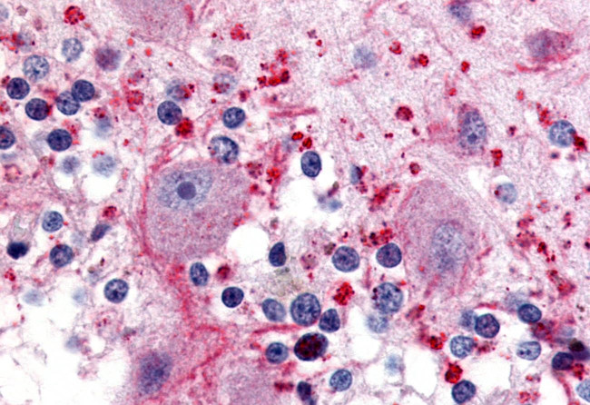 HTR5A Antibody in Immunohistochemistry (Paraffin) (IHC (P))