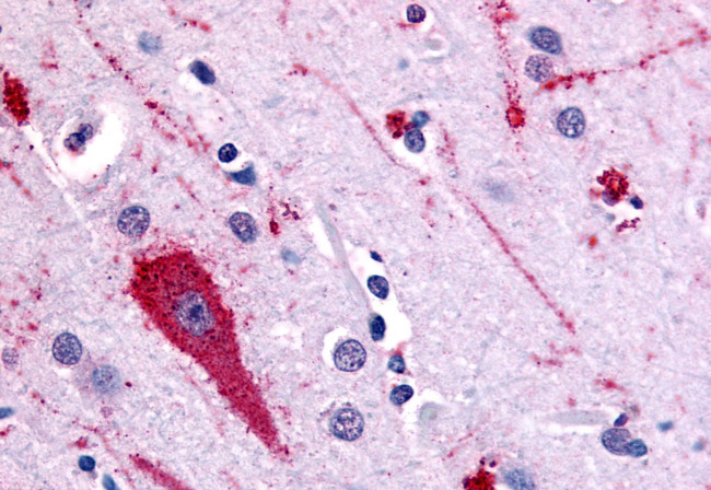 HTR5A Antibody in Immunohistochemistry (Paraffin) (IHC (P))