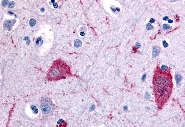 HTR5A Antibody in Immunohistochemistry (Paraffin) (IHC (P))