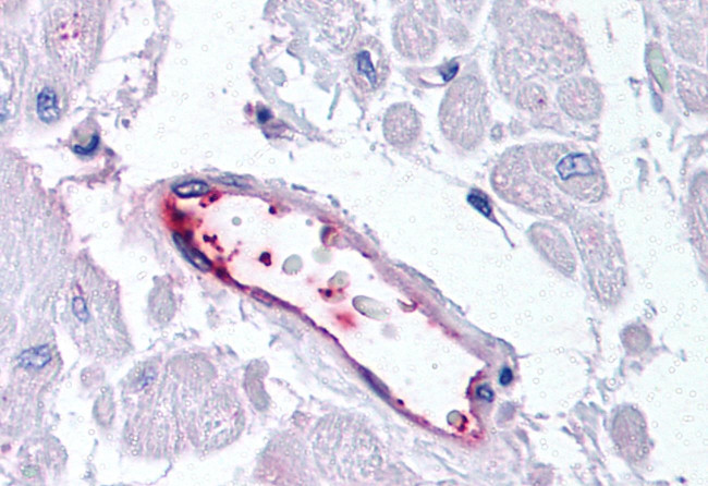 HUNK Antibody in Immunohistochemistry (Paraffin) (IHC (P))