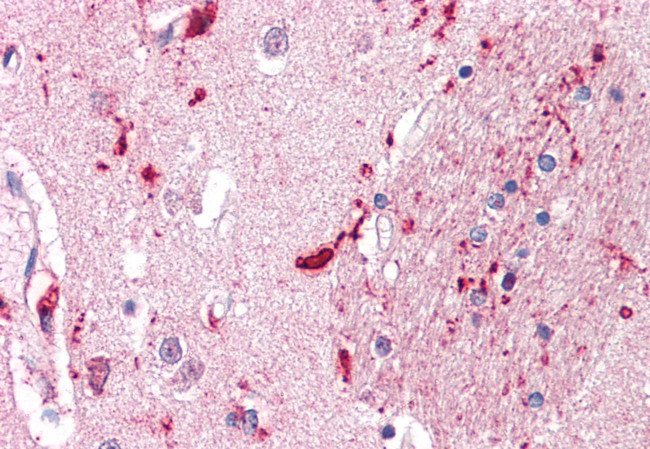 IGSF8 Antibody in Immunohistochemistry (Paraffin) (IHC (P))