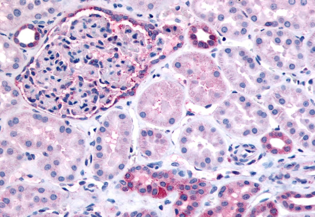 INPP5J Antibody in Immunohistochemistry (Paraffin) (IHC (P))