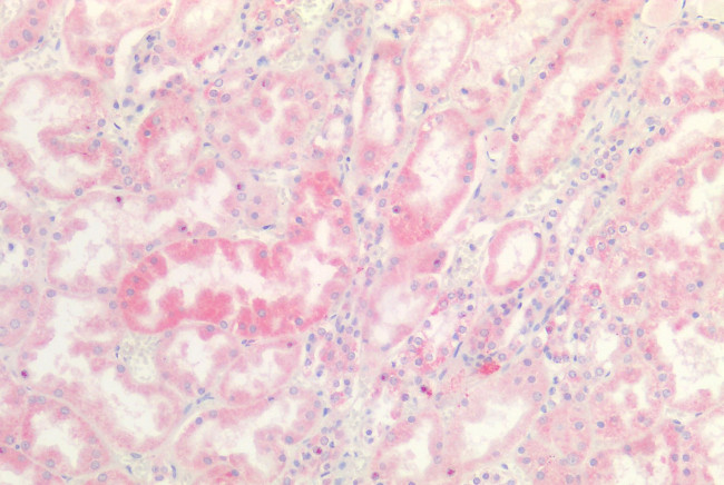 INSR Antibody in Immunohistochemistry (Paraffin) (IHC (P))