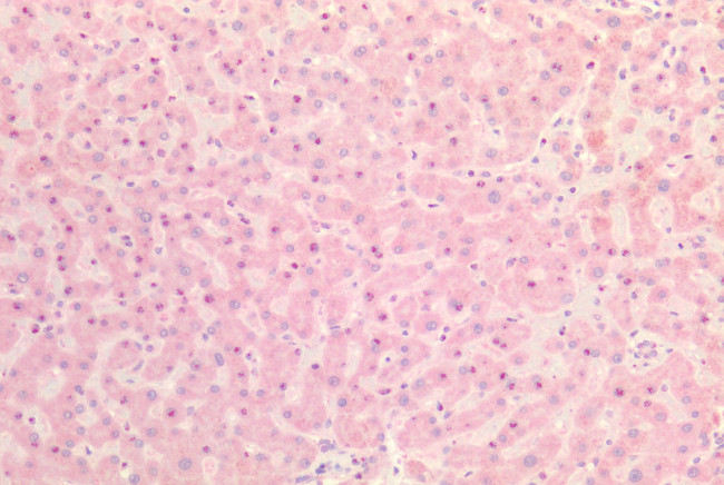 INSR Antibody in Immunohistochemistry (Paraffin) (IHC (P))