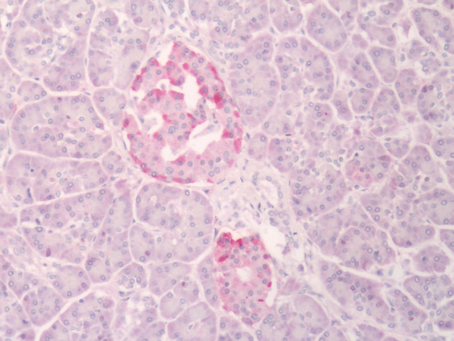 INSR Antibody in Immunohistochemistry (Paraffin) (IHC (P))