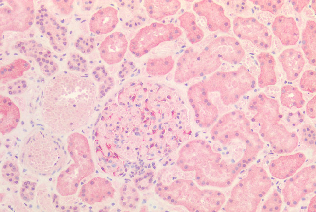 INSR Antibody in Immunohistochemistry (Paraffin) (IHC (P))