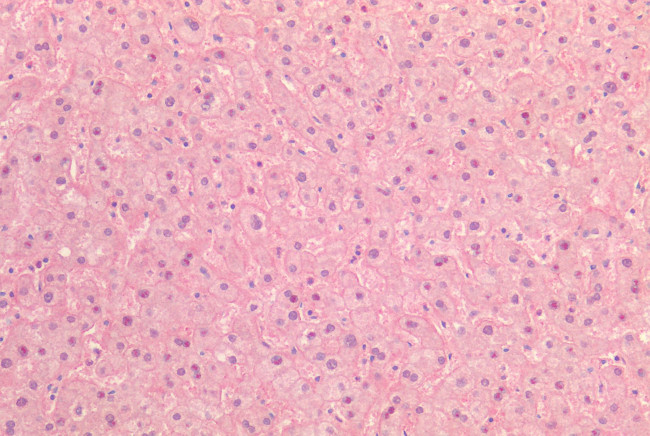 INSR Antibody in Immunohistochemistry (Paraffin) (IHC (P))