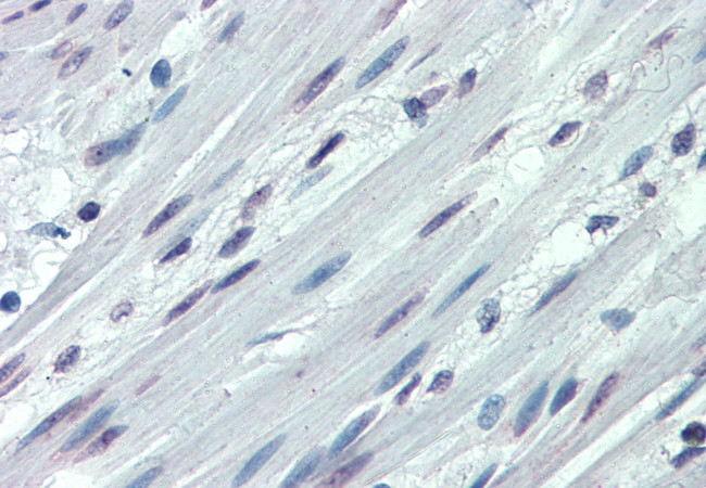 ITGA3 Antibody in Immunohistochemistry (Paraffin) (IHC (P))