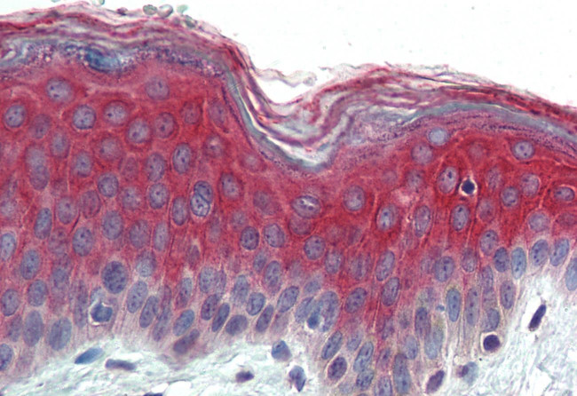 ITGA3 Antibody in Immunohistochemistry (Paraffin) (IHC (P))