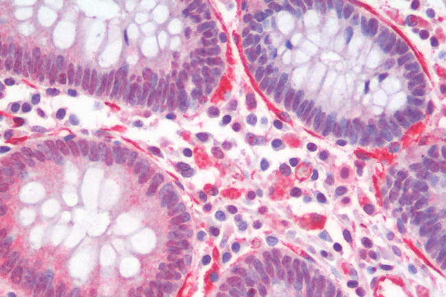 ITGA4 Antibody in Immunohistochemistry (Paraffin) (IHC (P))