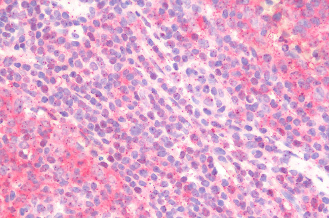 ITGA4 Antibody in Immunohistochemistry (Paraffin) (IHC (P))