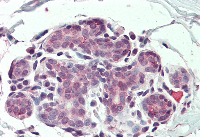 CD49f Antibody in Immunohistochemistry (Paraffin) (IHC (P))