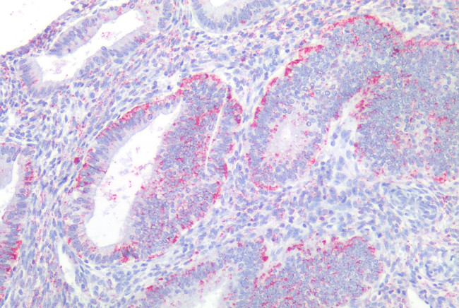 LPAR4 Antibody in Immunohistochemistry (Paraffin) (IHC (P))