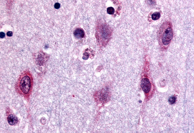 ERK1 Antibody in Immunohistochemistry (Paraffin) (IHC (P))