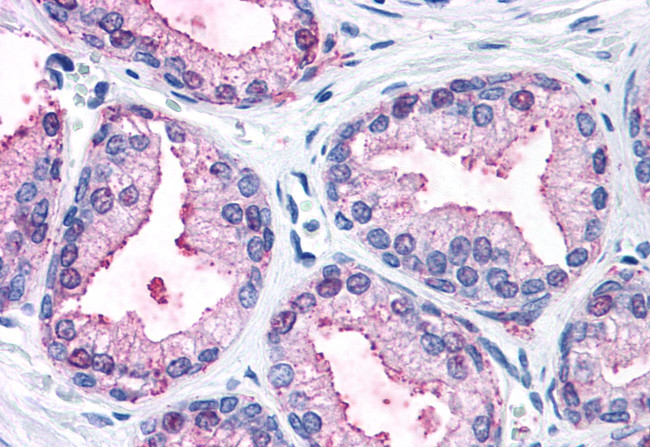 ERK1 Antibody in Immunohistochemistry (Paraffin) (IHC (P))