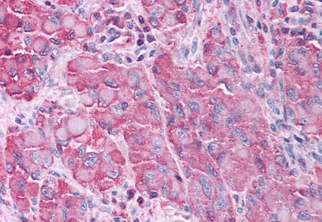 ERK1 Antibody in Immunohistochemistry (Paraffin) (IHC (P))