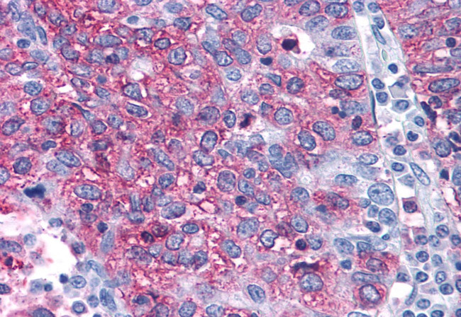 ERK1 Antibody in Immunohistochemistry (Paraffin) (IHC (P))