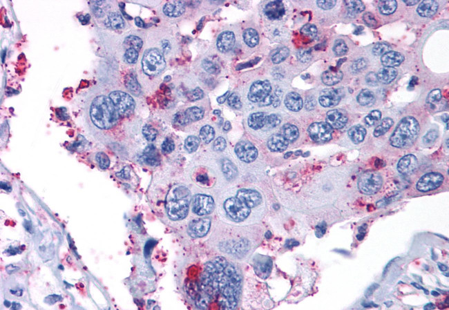 ERK1 Antibody in Immunohistochemistry (Paraffin) (IHC (P))