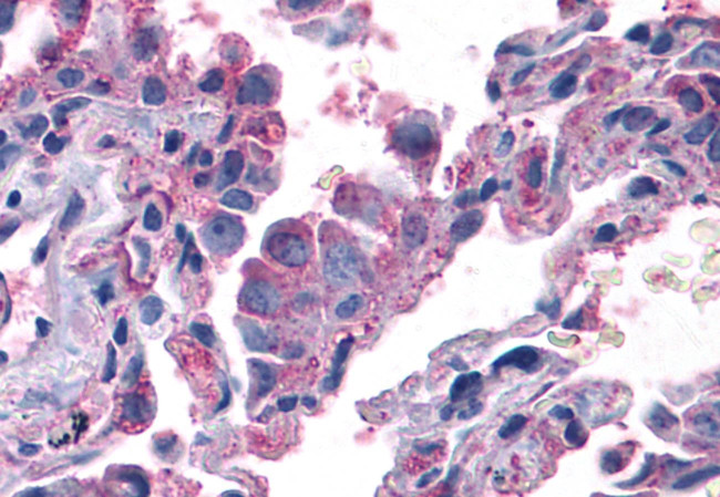 ERK1 Antibody in Immunohistochemistry (Paraffin) (IHC (P))