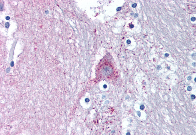 MARK1 Antibody in Immunohistochemistry (Paraffin) (IHC (P))