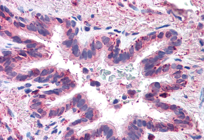 MFI2 Antibody in Immunohistochemistry (Paraffin) (IHC (P))