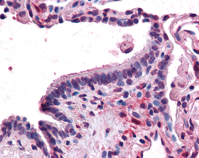 MFI2 Antibody in Immunohistochemistry (Paraffin) (IHC (P))